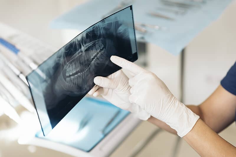 At Optismile, a dental professional examines a dental X-ray as part of their precise diagnostic measures.