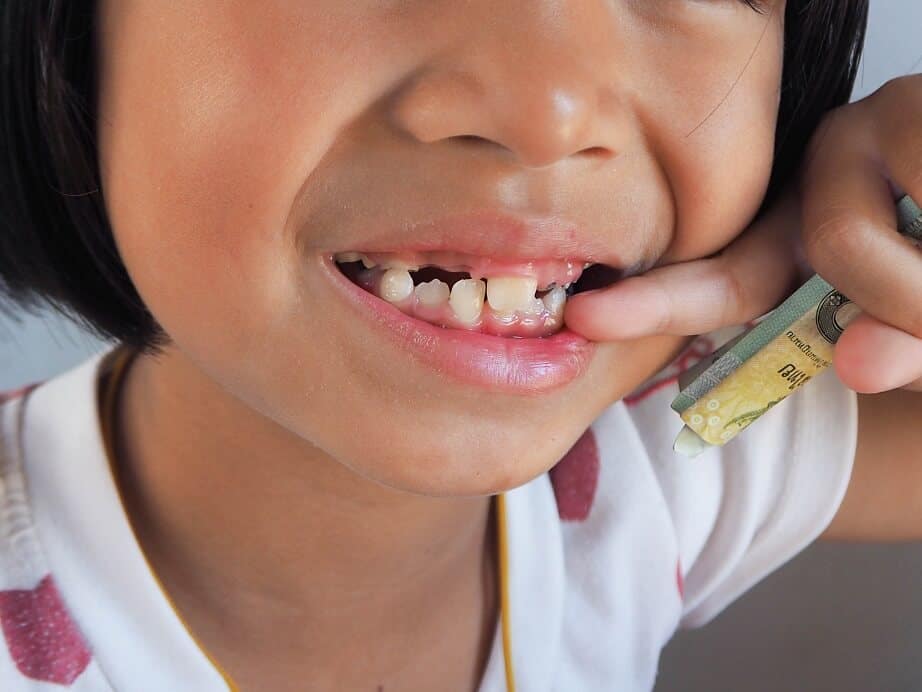 A Child Pointing At Damaged Teeth Showcasing The Need For Dental Intervention.
