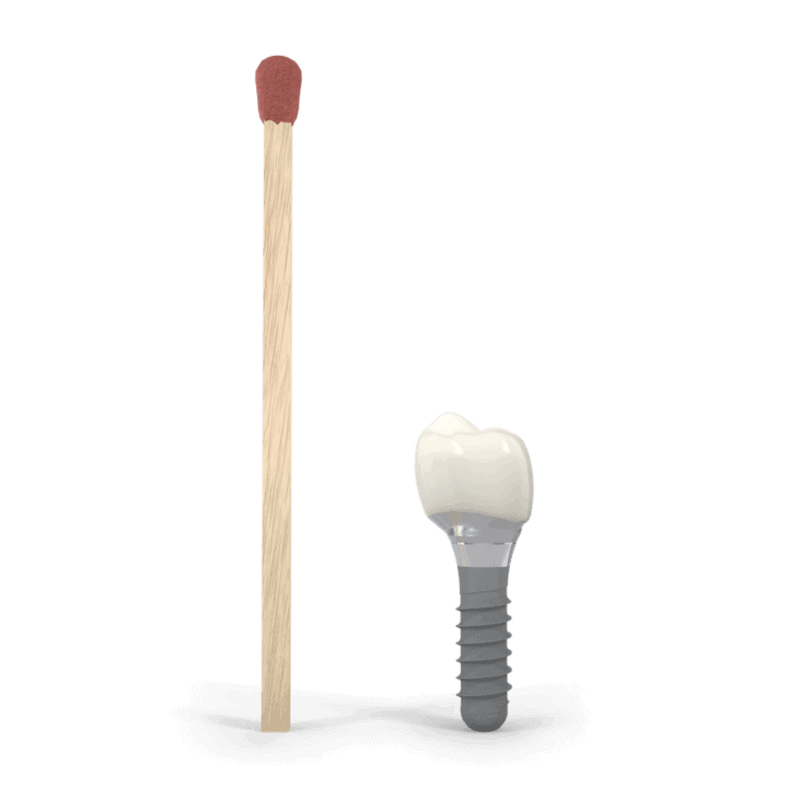 dental implant cape town