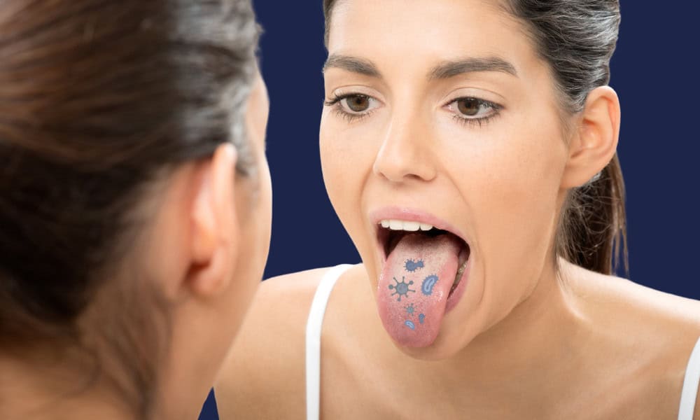 A lady looking at her mouth in the mirro with germs on her tongue.