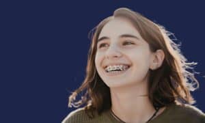 Teenage girl smiling confidently with metal braces during orthodontic treatment at OptiSmile Cape Town.