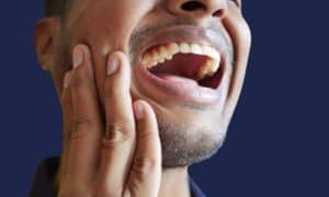 Man holding his jaw in pain with visible gum inflammation with the signs of gum disease and deep periodontal pockets